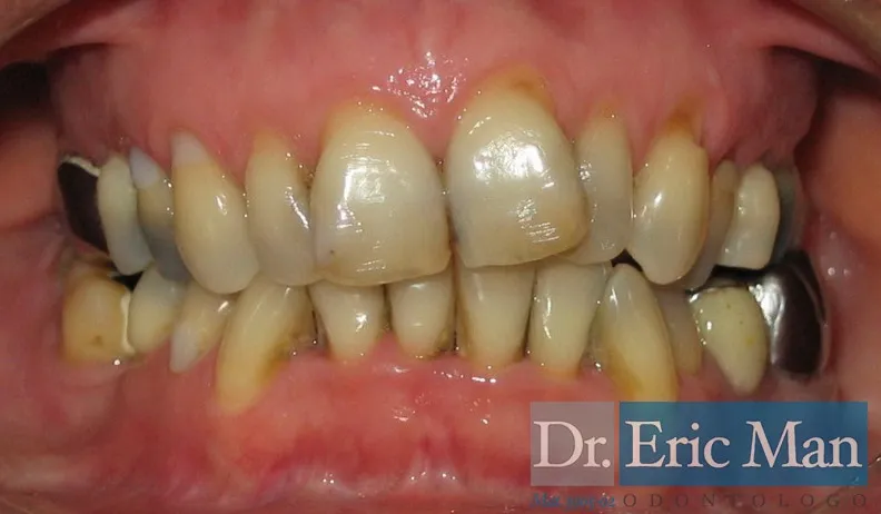 Cosmetica Dental, comparación 2: antes