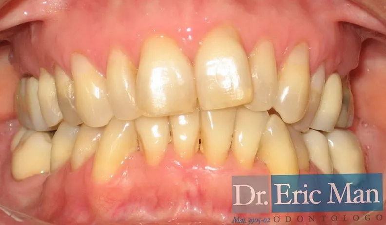 Cosmetica Dental, comparación 2: después