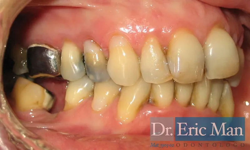 Cosmetica Dental, comparación 3: antes