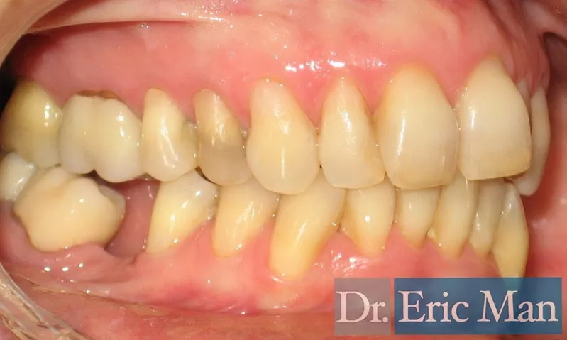 Cosmetica Dental, comparación 3: después