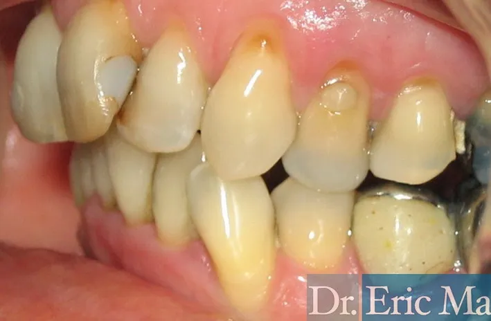 Cosmetica Dental, comparación 4: antes