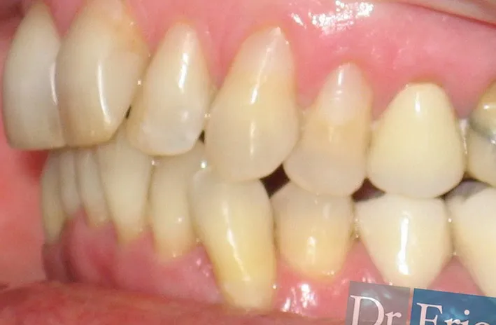 Cosmetica Dental, comparación 4: después