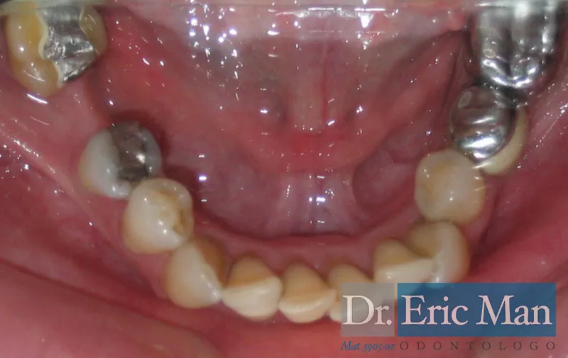 Cosmetica Dental, comparación 5: antes