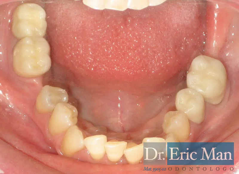 Cosmetica Dental, comparación 5: después