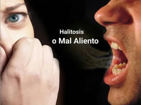 Mal aliento o halitosis