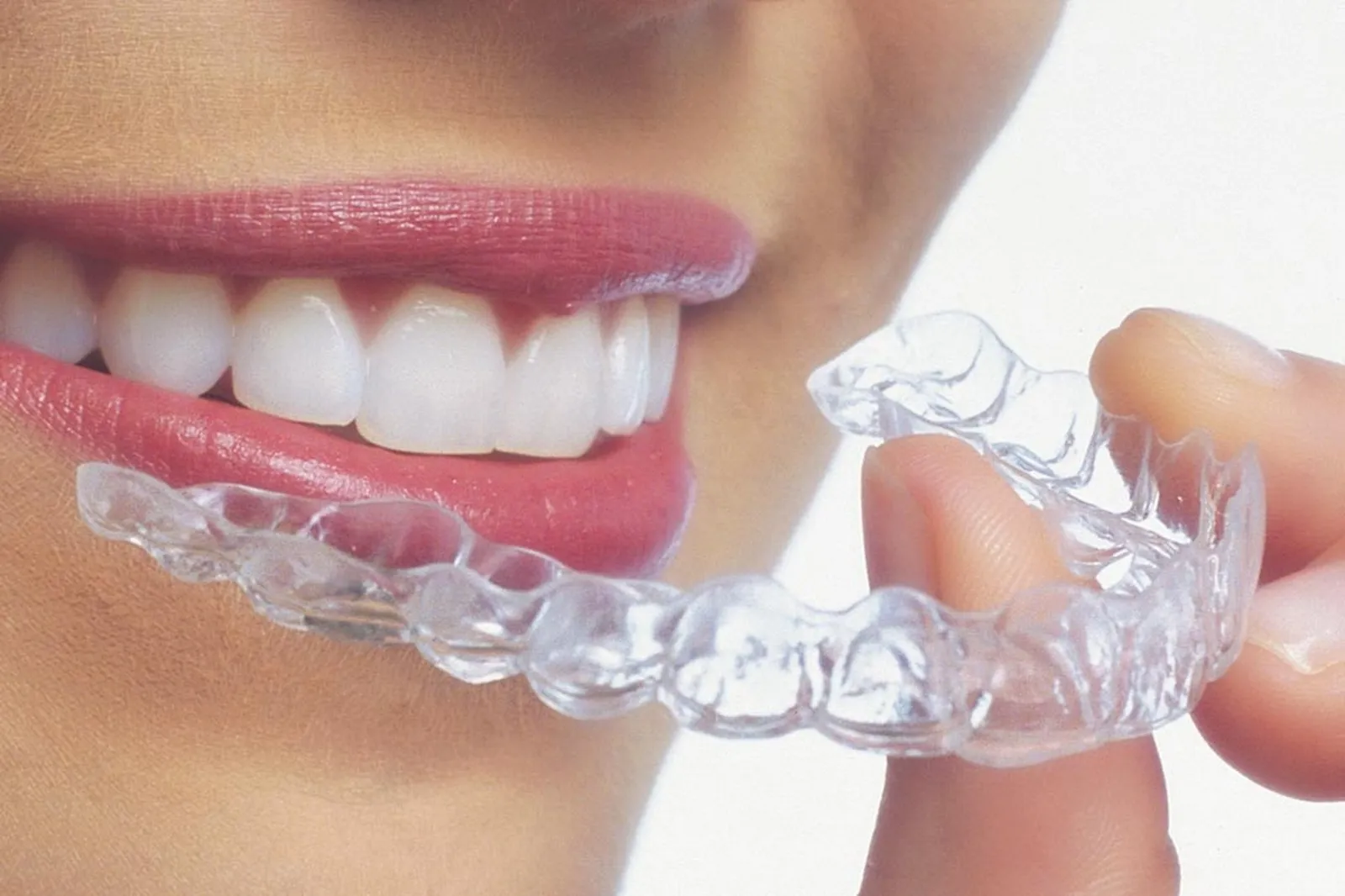 Una sonrisa junto al alineador transparente, que se sostiene entre los dedos